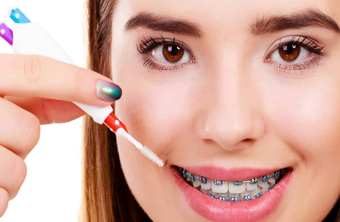 Braces